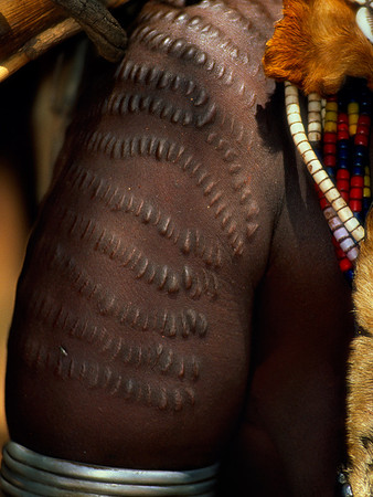 Scarification