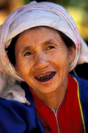 Tooth worm